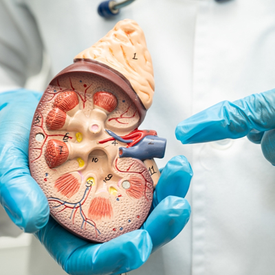 Diabetes and Kidney Damage